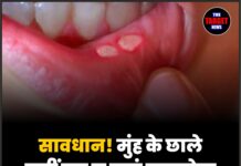 सावधान! मुंह के छाले कहीं बन न जाएं जानलेवा बीमारी का संकेत