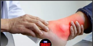 यूरिक एसिड के लिए किचन की 3 रामबाण चीजें