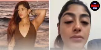 मशहूर अभिनेत्री का क्लब में हुआ झगड़ा! बुरी तरह पीटा, दांत तोड़ दिए, चेहरा भी सूज गया