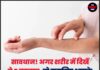 सावधान ! अगर शरीर में दिखें ये 5 बदलाव,तो समझिए आपके गुर्दे हो रहे है खराब।