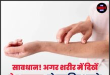 सावधान ! अगर शरीर में दिखें ये 5 बदलाव,तो समझिए आपके गुर्दे हो रहे है खराब।