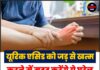 यूरिक एसिड को जड़ से खत्म करने में मदद करेंगे ये घरेलू उपाय, पढ़ें पूरी खबर